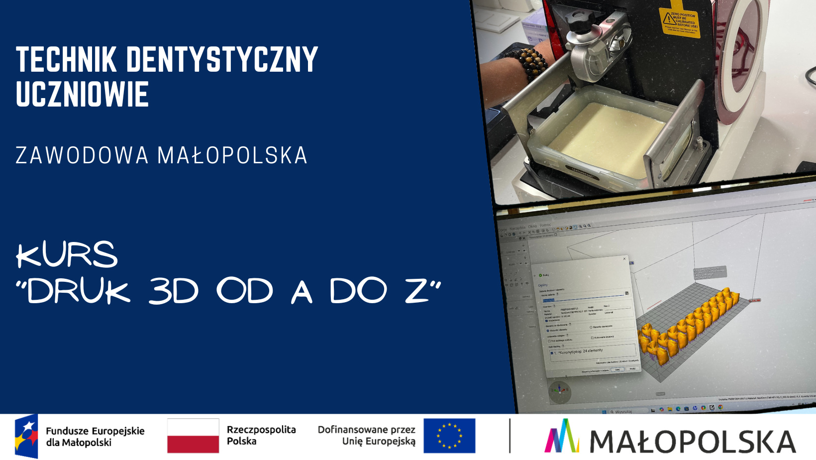 Grafika promująca kurs Druk 3D od A do Z dla uczniów kierunku technik dentystyczny w projekcie Zawodowa Małopolska. Po prawej stronie zdjęcia przedstawiają drukarkę 3D z żywicą oraz podgląd modelu zębów w programie do projektowania. U dołu logotypy Funduszy Europejskich, Rzeczypospolitej Polskiej, Unii Europejskiej i Województwa Małopolskiego