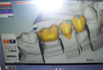 Zbliżenie na ekran monitora