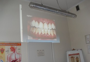 Zrzut z rzutnika obrazujący szczękę