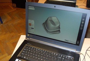 Komputerowe projektowanie prac protetycznych