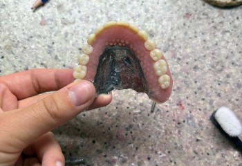 Zdjęcie przedstawia wykonaną pracę protetyczną